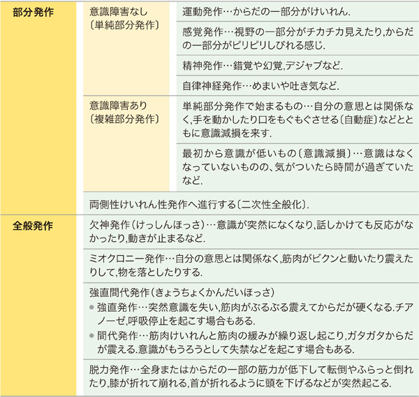 てんかんの主な症状の発作とは